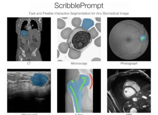 Speed and Precision in Medical Imaging: The Promise of ScribblePrompt Speed and Precision in Medical Imaging: The Promise of ScribblePrompt