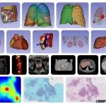 MHub.ai: Standardizing AI for Reproducible Medical Imaging Diverse model landscape