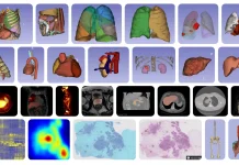 MHub.ai: Standardizing AI for Reproducible Medical Imaging Diverse model landscape