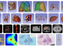 MHub.ai: Standardizing AI for Reproducible Medical Imaging Diverse model landscape
