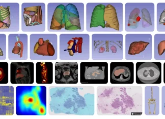 MHub.ai: Standardizing AI for Reproducible Medical Imaging Diverse model landscape