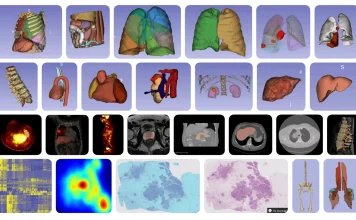 MHub.ai: Standardizing AI for Reproducible Medical Imaging Diverse model landscape