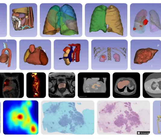 MHub.ai: Standardizing AI for Reproducible Medical Imaging Diverse model landscape